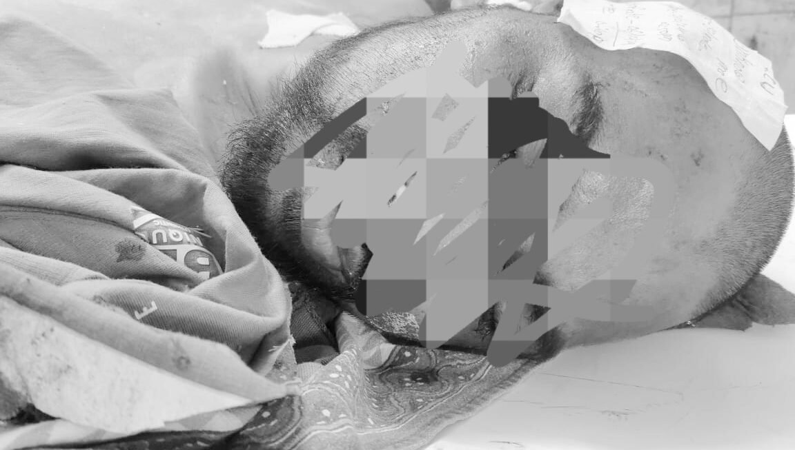 उपचारादरम्यान मयत झालेल्या इसमाच्या नातेवाईकांचा पनवेल शहर पोलिसांच्या मार्फत शोध सुरू